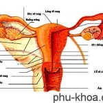 tử cung thường gặp