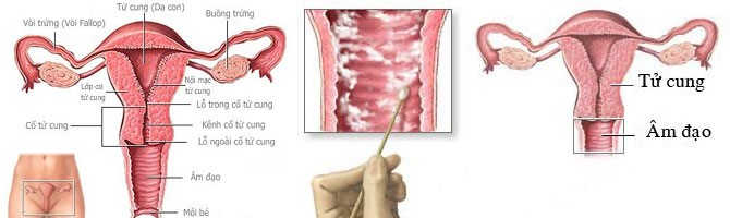 Hình ảnh bệnh viêm âm đạo hình ảnh viêm âm đạo