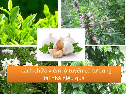 Cách chữa viêm lộ tuyến cổ tử cung tại nhà đơn giản 