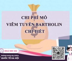 chi-phi-mo-viem-tuyen-bartholin