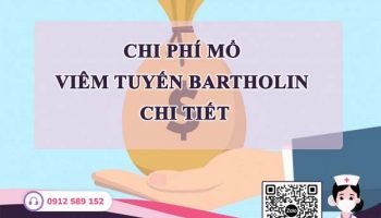 Chi phí mổ viêm tuyến bartholin hiện nay là bao nhiêu?