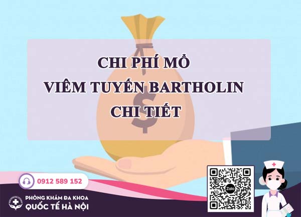 chi phí chữa viêm tuyến bartholin