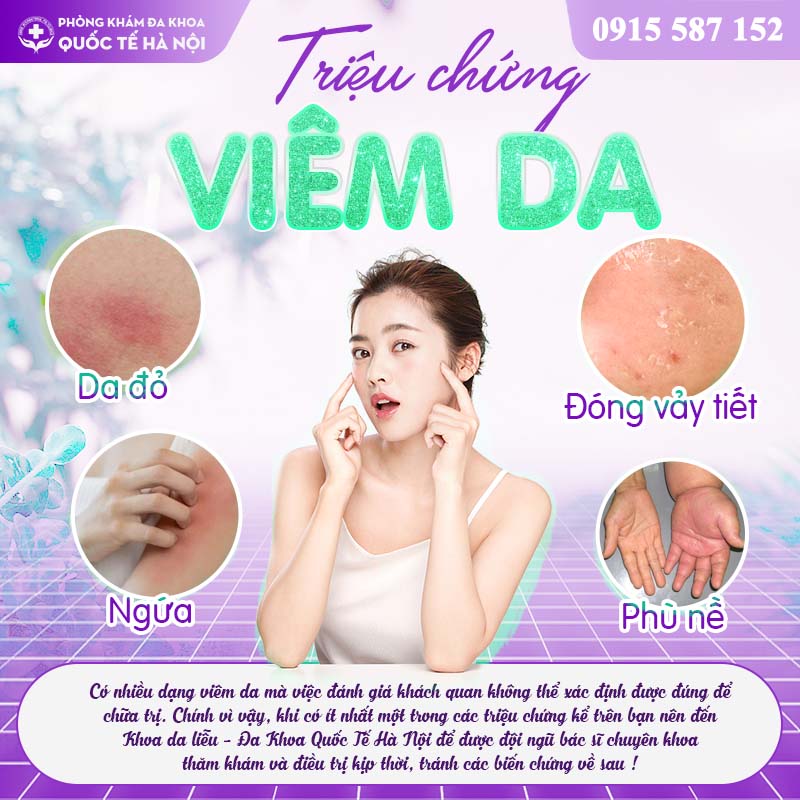 triệu chứng viêm da