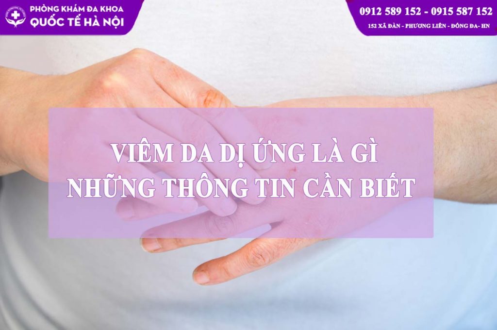 viêm da dị ứng là gì