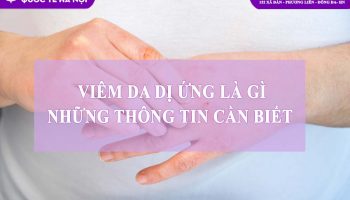 Viêm da dị ứng là gì: Tổng hợp thông tin từ A – Z