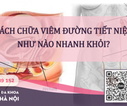 cach-chua-viem-duong-tiet-nieu