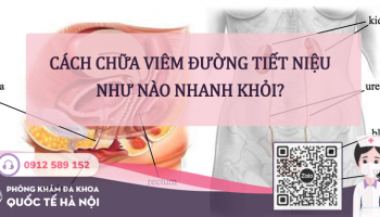 Cách chữa viêm đường tiết niệu [Top 3 phương pháp thường dùng]