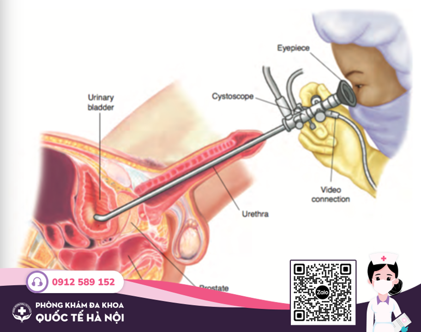 cách chữa viêm đường tiết niệu tại phòng khám đa khoa quốc tế hà nội