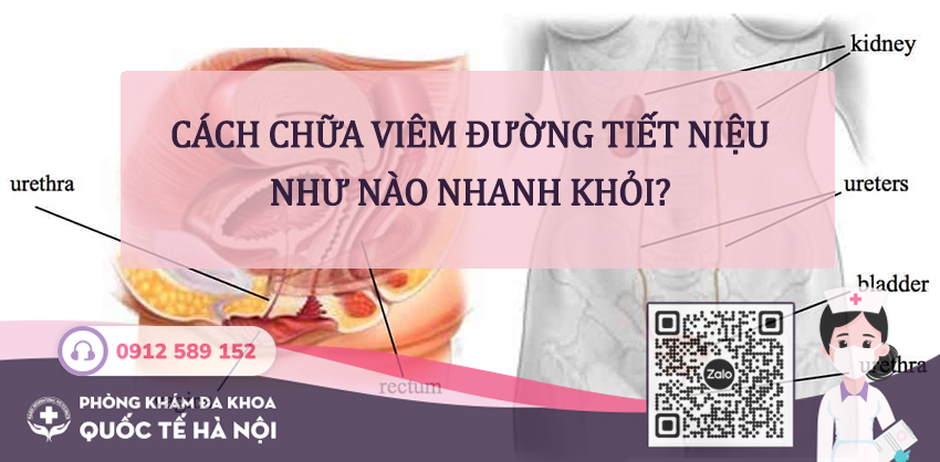 cách chữa viêm đường tiết niệu