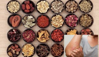 [Tiết lộ] Cách chữa viêm da dị ứng bằng đông y hiệu quả nhất hiện nay