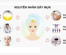nguyen-nhan-gay-mun-trung-ca