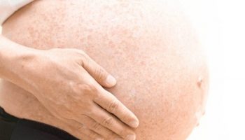 Bà bầu bị viêm da dị ứng chữa như thế nào để không ảnh hưởng thai nhi?