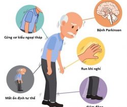 parkinson-theo-y-hoc-co-truyen