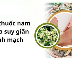 cay-thuoc-nam-chua-suy-gian-tinh-mach