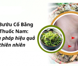 chua-buou-co-bang-cay-thuoc-nam
