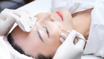 [Chỉ điểm] 13 ++ Cách trị mụn trứng cá hiệu quả nhất hiện nay
