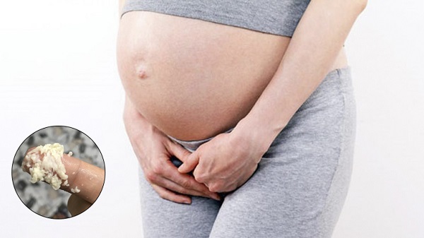 Ra khí hư bã đậu khi mang thai có sao không?