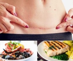 sinh-mo-xong-co-duoc-an-hai-san-khong