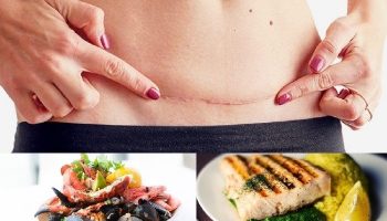 Sinh mổ xong có được ăn hải sản không?