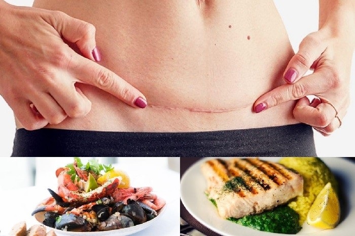 Sinh mổ xong có được ăn hải sản không?