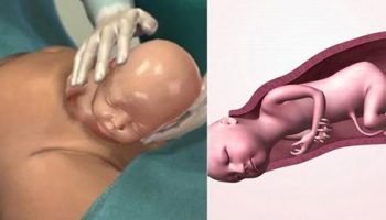 [GIẢI ĐÁP] NÊN SINH THƯỜNG HAY SINH MỔ?