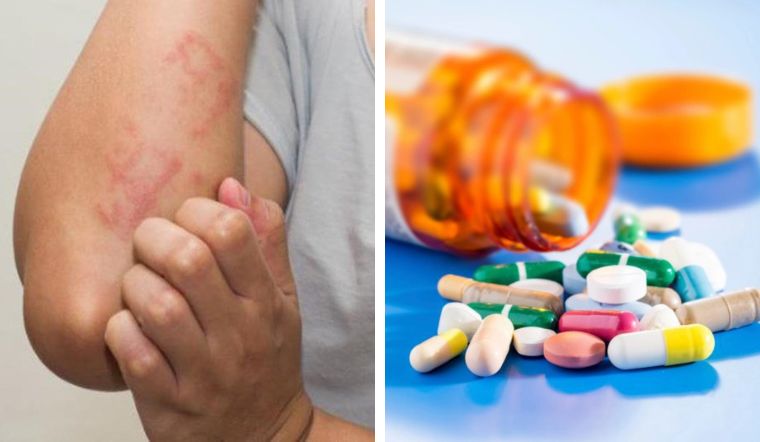 Cẩn trọng khi dùng các loại thuốc chống dị ứng 