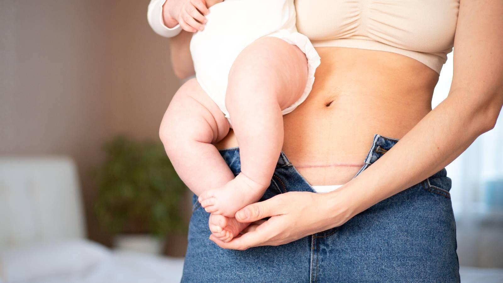 Đẻ mổ bao lâu thì có thể mang thai tiếp