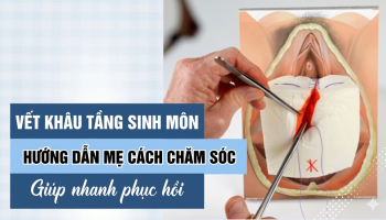 CHĂM SÓC VẾT THƯƠNG SAU SINH NHƯ THẾ NÀO ĐỂ NHANH LÀNH?