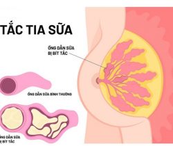 tac-tia-sua-sau-sinh