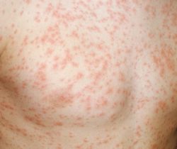 toan-than-noi-man-do