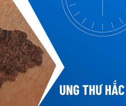 dau-hieu-som-cua-ung-thu-hac-to-da-la-gi