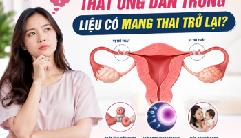 THẮT ỐNG DẪN TRỨNG LIỆU CÓ MANG THAI TRỞ LẠI KHÔNG?