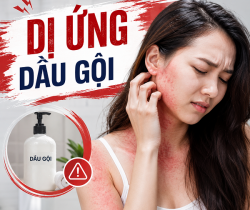 di-ung-dau-goi