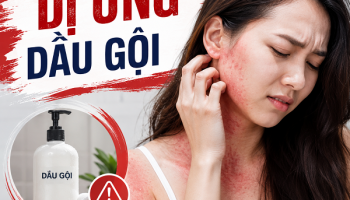 DỊ ỨNG DẦU GỘI: NGUYÊN NHÂN, DẤU HIỆU & CÁCH XỬ LÝ CHÍNH XÁC