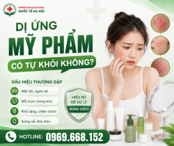 di-ung-my-pham-co-tu-khoi-khong