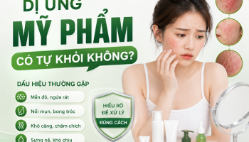 Dị ứng mỹ phẩm có tự khỏi không? Đọc bài viết để có câu trả lời