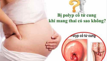 Mang thai bị Polyp cổ tử cung có sao không? Bác sĩ trả lời