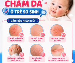 cham-da-o-tre-so-sinh