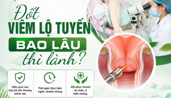 Đốt viêm lộ tuyến bao lâu thì lành? [Bác sĩ chuyên khoa giải đáp]