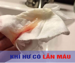 khi-hu-lan-mau-co-sao-khong