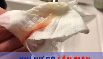 Khí hư lẫn máu có sao không? Khi nào cần đi khám ngay?