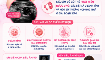 Siêu âm có phát hiện được u vú không? Câu trả lời của bác sĩ