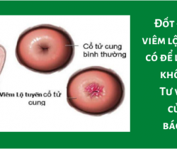 dot-viem-lo-tuyen-co-de-lai-seo-khong