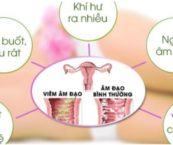 quan-he-lan-dau-co-bi-viem-am-dao-khong